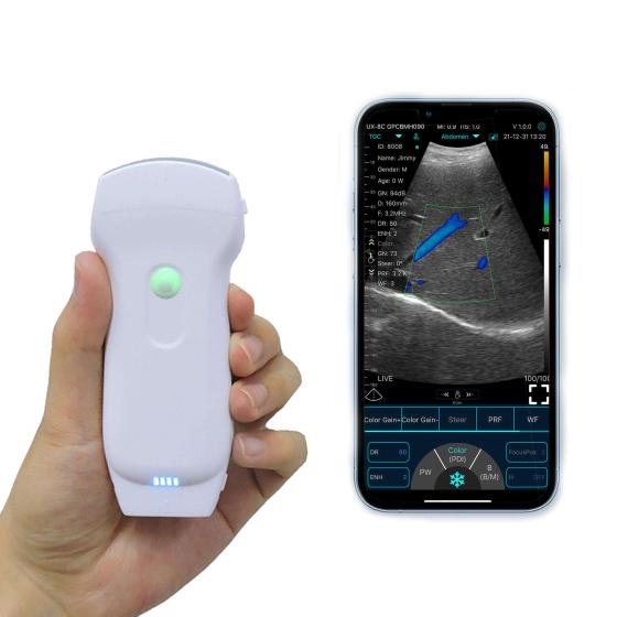 Hot Selling Handheld Wireless Color Doppler Ultrasound Convex&linear&cardiac Probes 128 Elements Ultrasound Scanner