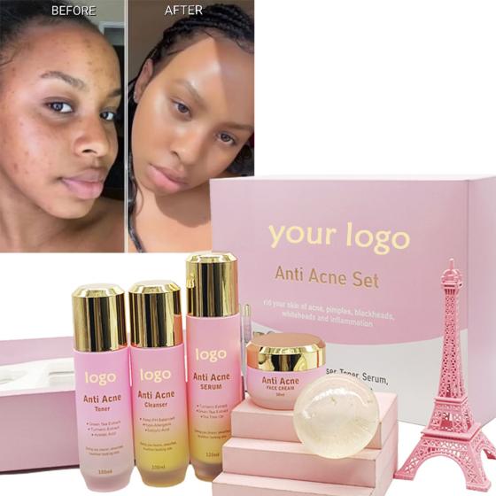 Private Label Customized logo Skin Care Set Anti Acne skin care products for Anti Acne skin care supliments Acne Treatment